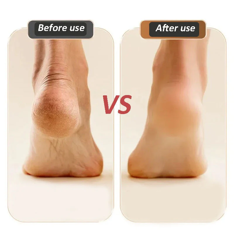 Practical Electric Callus Foot Grinder - Image 7