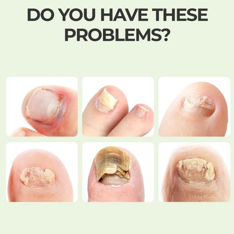 Nail Repair Magic Drops - Image 5