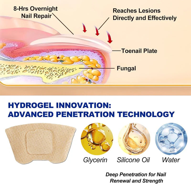 New Upsell - Fungal Nail Patches - Image 10