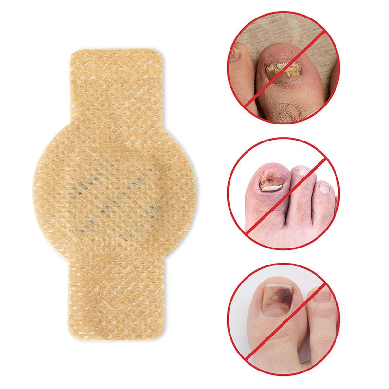 New Upsell - Fungal Nail Patches - Image 4
